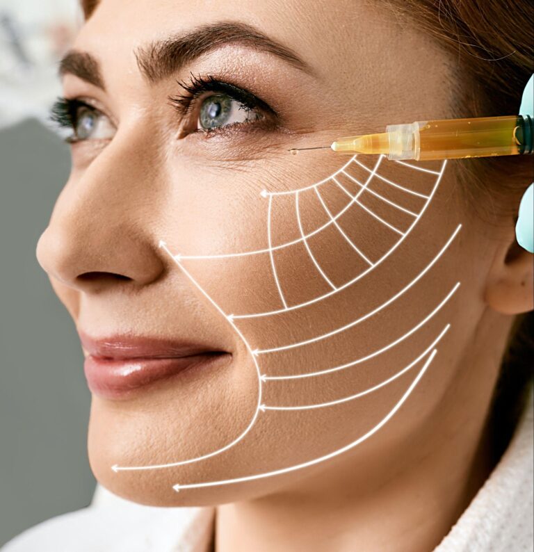 Syringe held near a woman's cheek with guide lines drawn over the face