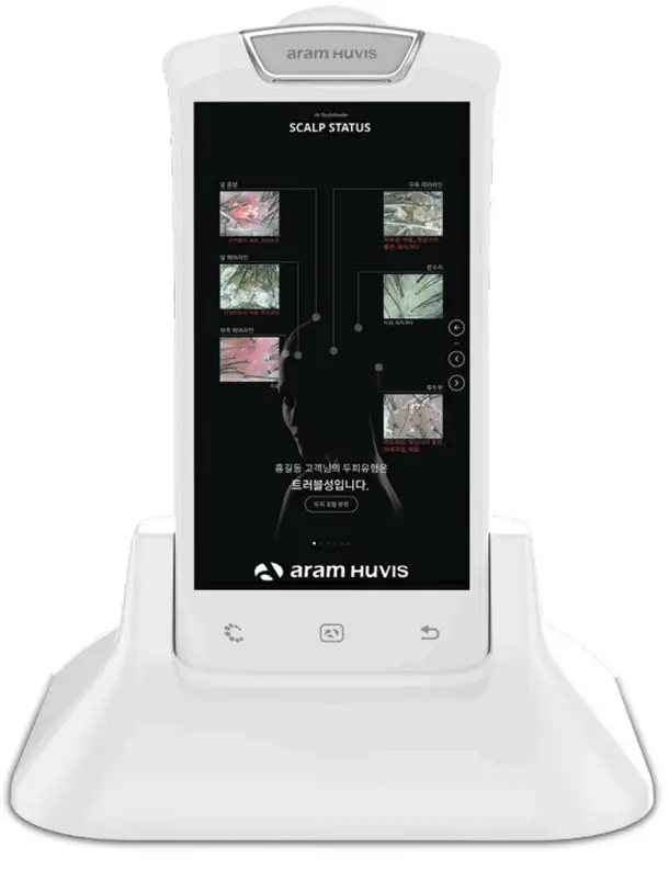 Aram Huvis scalp analysis device displaying scalp images and analysis results